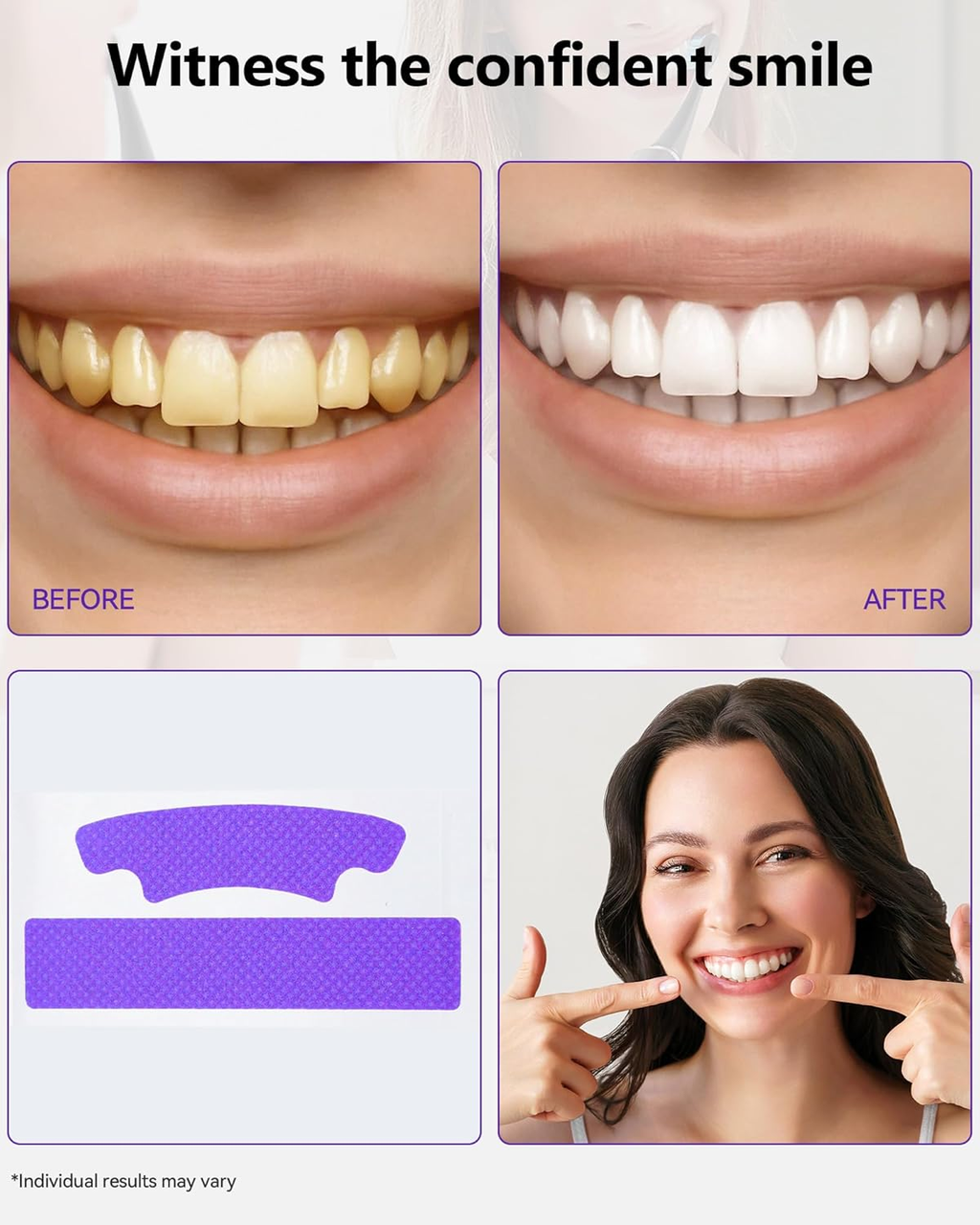 Camera-Ready Smile Upgrade Kit